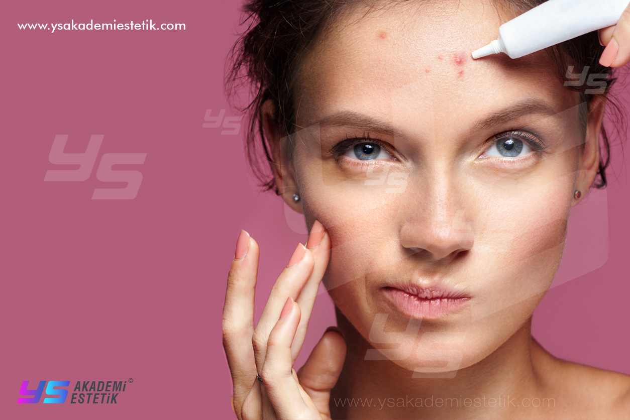 akne tedavisi pendik